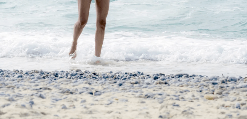 варикозное расширение вен